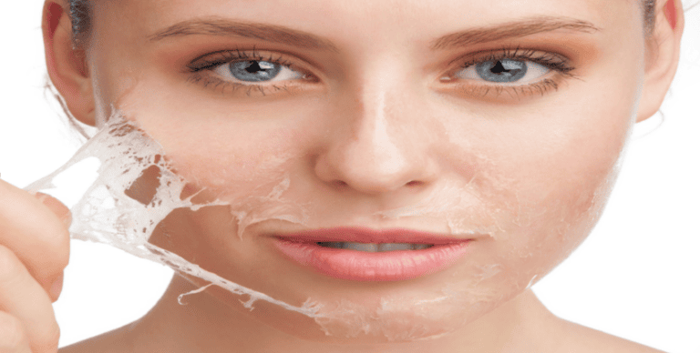 Peeling de fenol