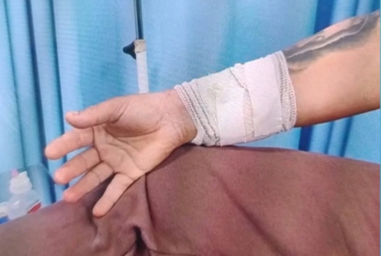 Vítima oi ferida na mão e no intestino durante tentativa de roubo. Foto: Reprodução