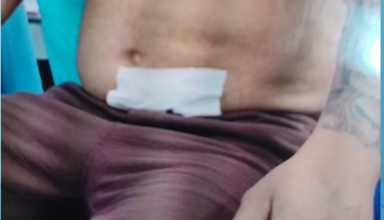 Motorista de aplicativo, mesmo com perfuração no intestino, consegue dirigir até hospital; criminoso é preso em flagrante pela PM